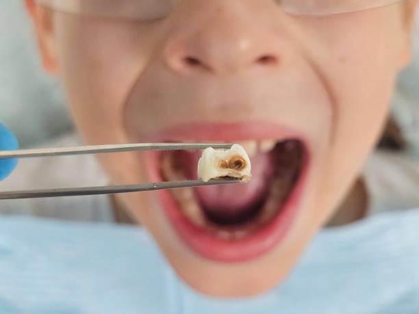Best Emergency Cosmetic Dentistry (e.g., broken veneers) in Kempner, TX